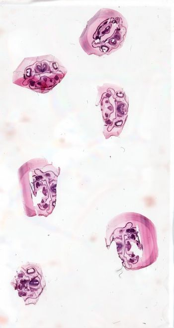 Media type: image; Special Collections 3992   shows specimen_part histological serial section;